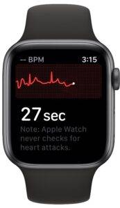 how-to-record-ecg-on-apple-watch-5-173x300-1