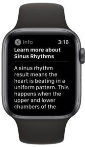 how-to-record-ecg-on-apple-watch-7-173x300-1