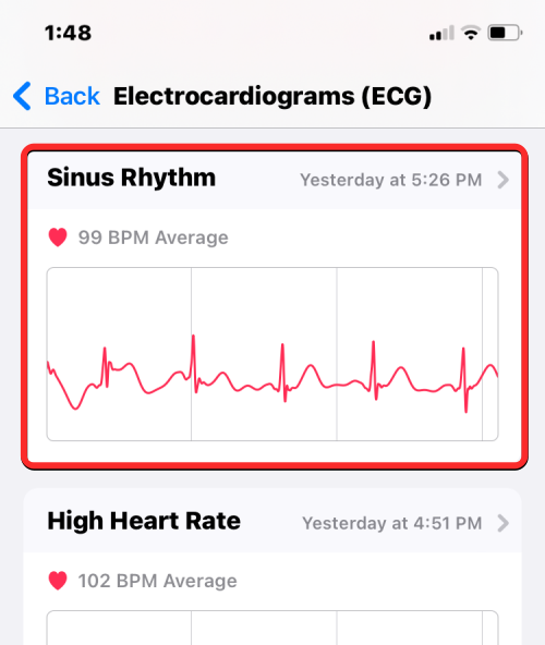 ecg-reading-on-iphone-6-a-1