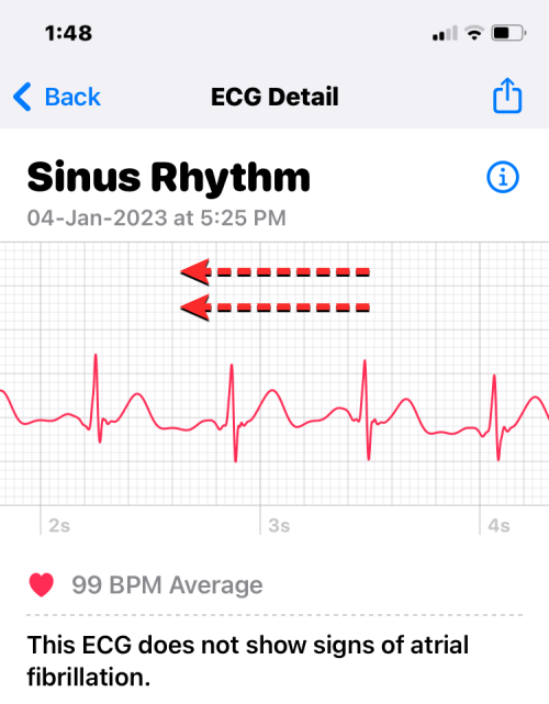ecg-reading-on-iphone-8-a