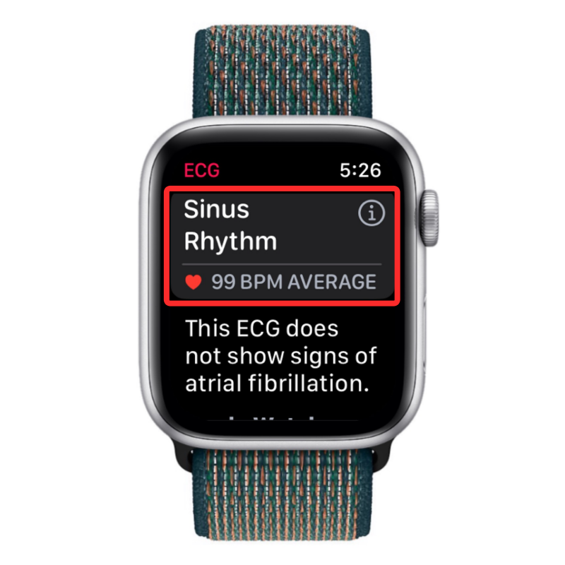 take-an-ecg-reading-on-apple-watch-9-a